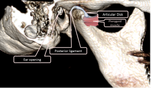Normal TMJ anatomy