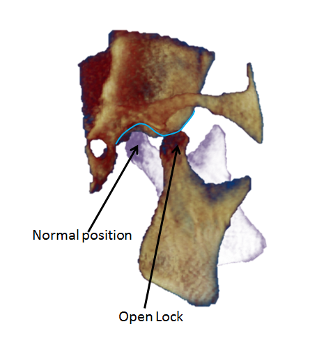 Open lock 2