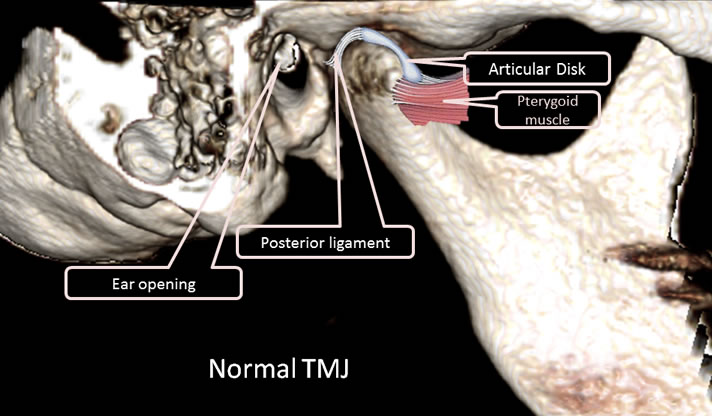 normal_tmj