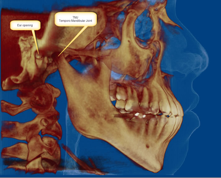 skull_with_tmj